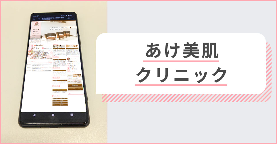 あけ美肌クリニックの公式サイトを映したスマホの写真