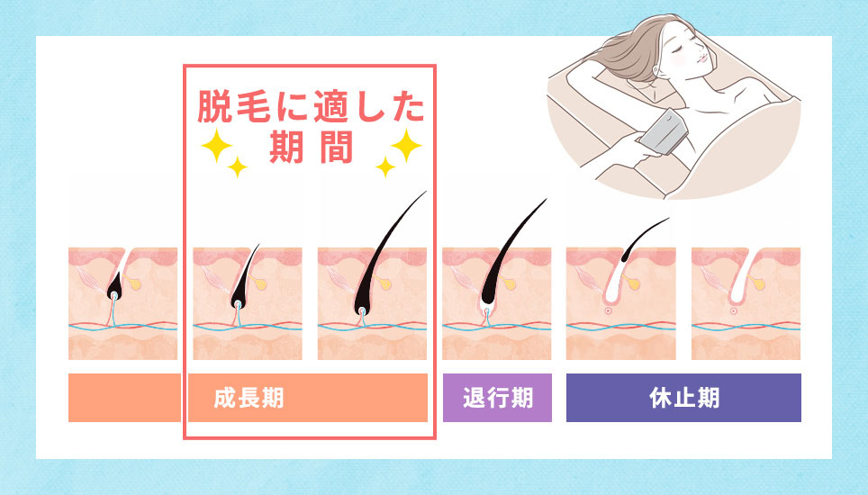 脱毛に適した期間の図説