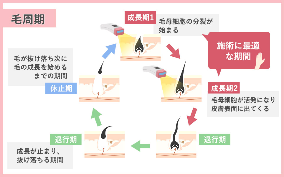 毛周期