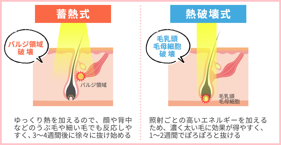 蓄熱式と熱破壊式の違いまとめ