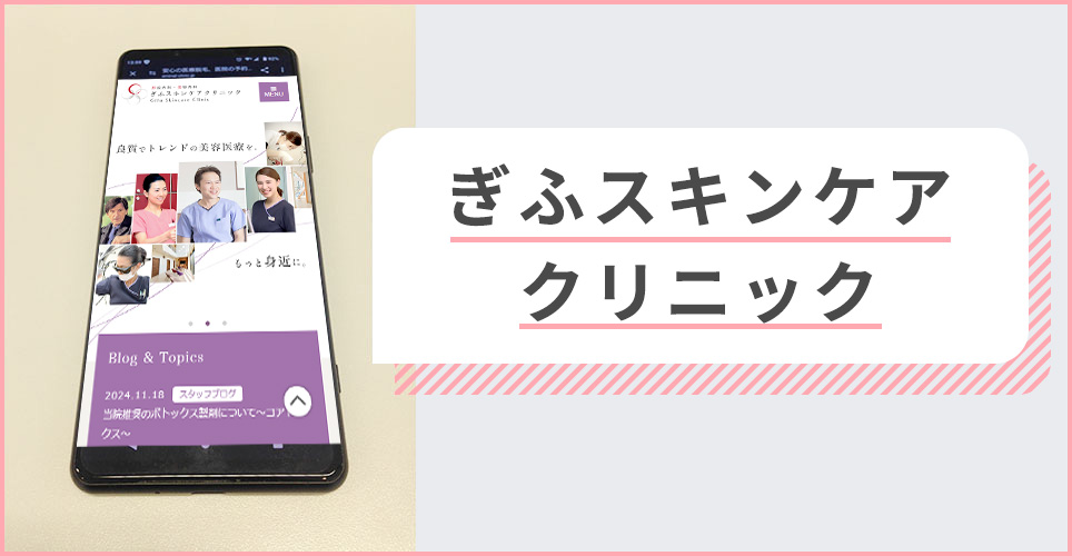 ぎふスキンケアクリニックの公式サイトを映したスマホの写真