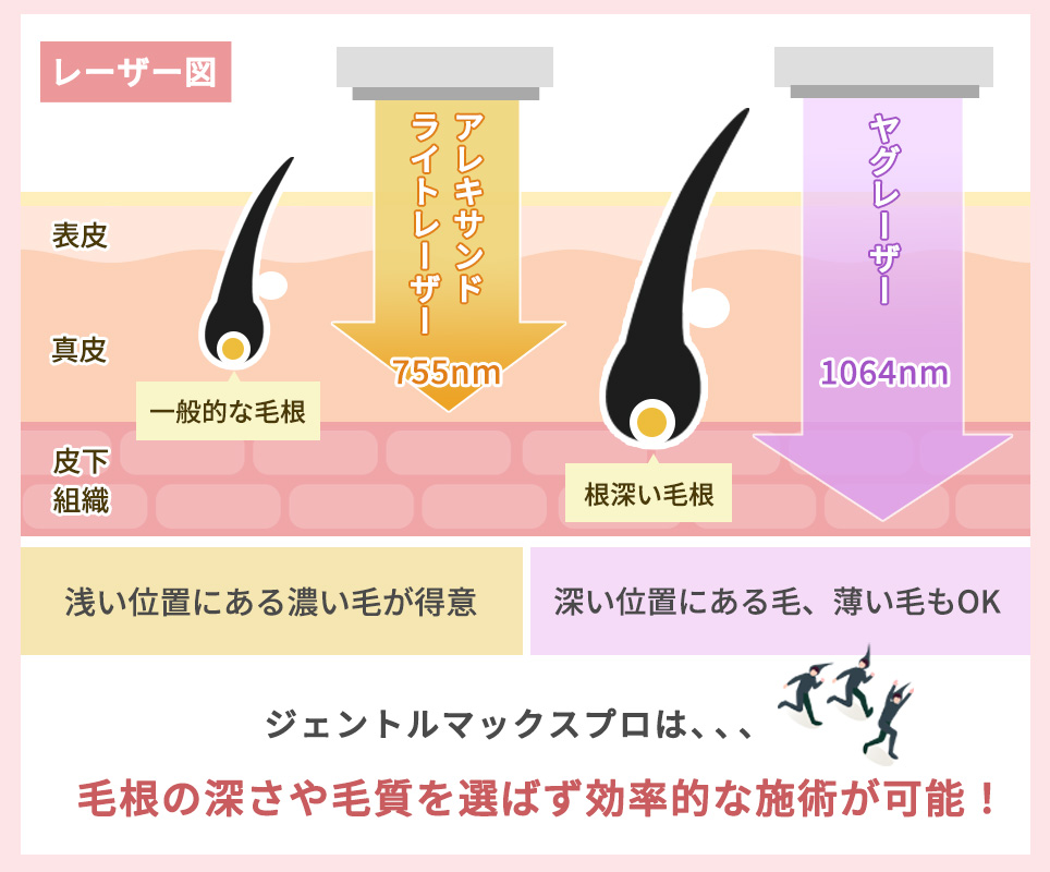 2種類のレーザーが照射できる