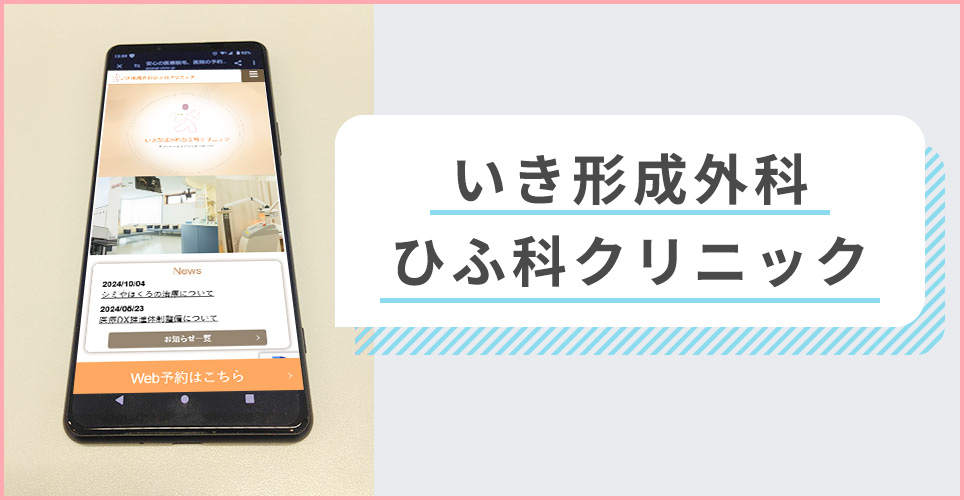 エミナルクリニックメンズの公式サイトを映したスマホの写真