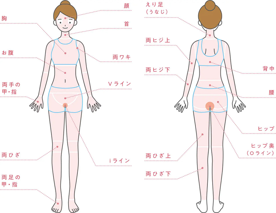 じぶんクリニックの全身＋VIO＋顔脱毛の部位一覧