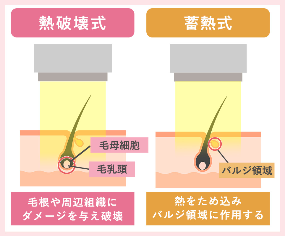 熱破壊式と蓄熱式の違い