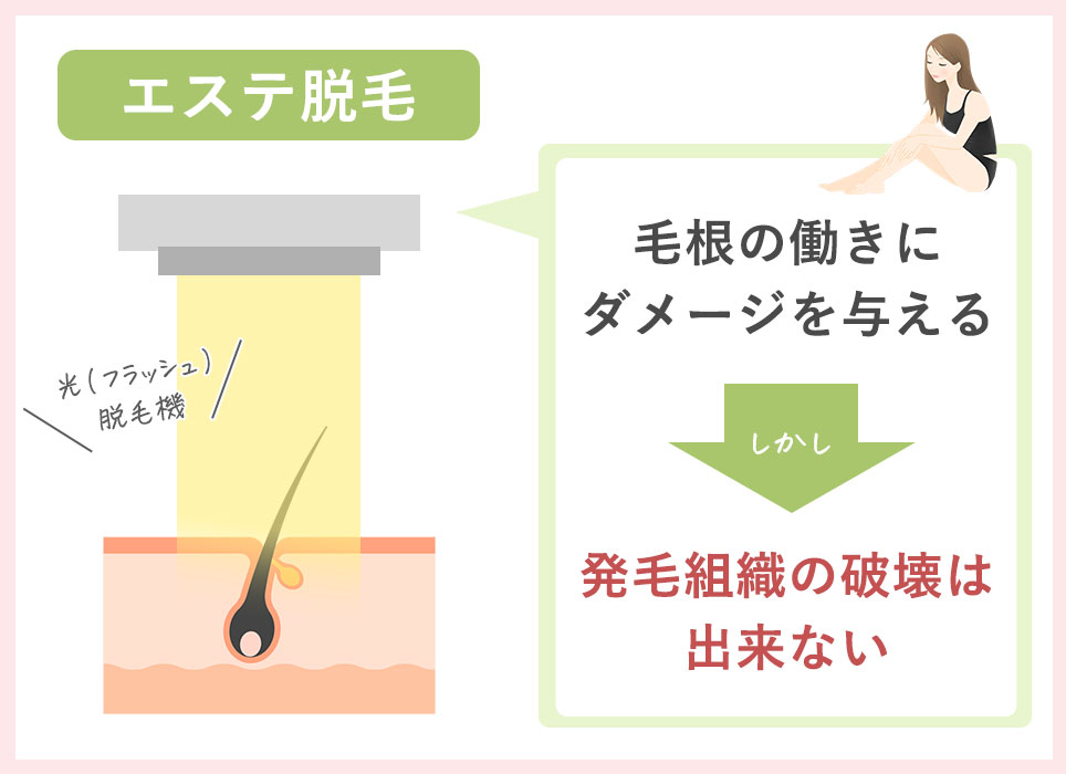 エステやサロン脱毛は?