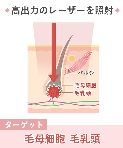 熱破壊式