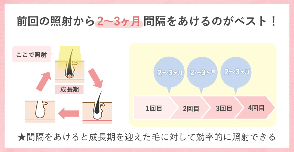 照射間隔