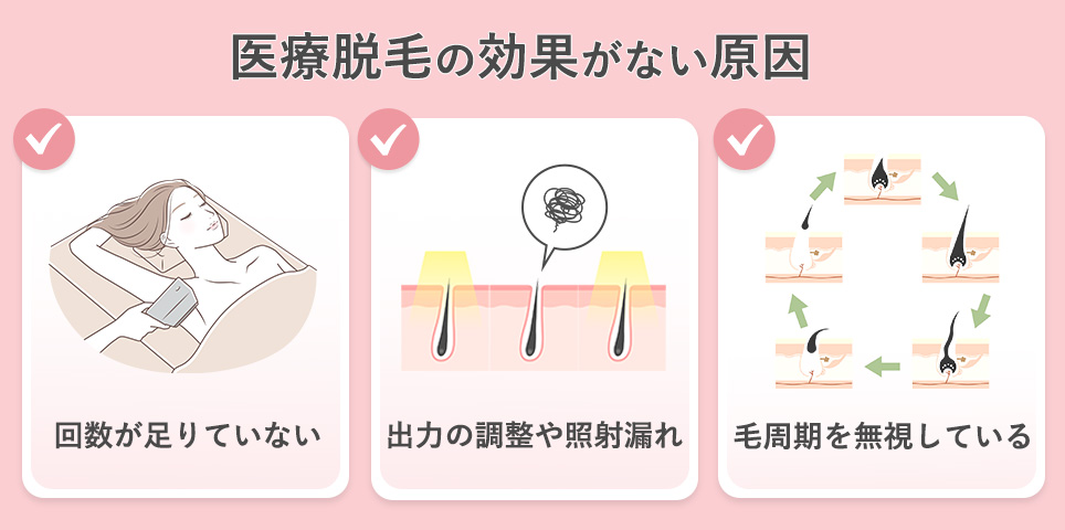 医療脱毛の効果がない原因