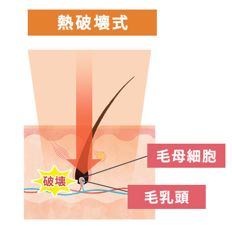 熱破壊式の比較画像