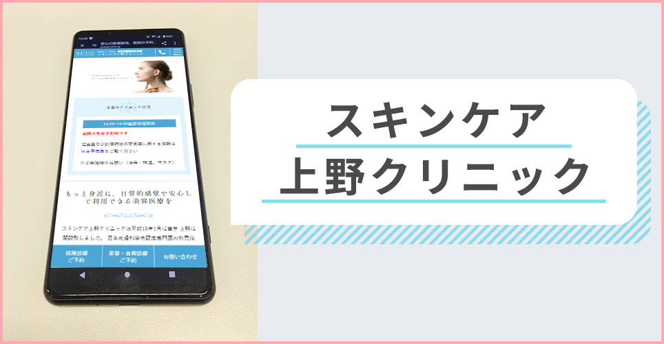 スキンケア上野クリニックの公式サイトを映したスマホの写真