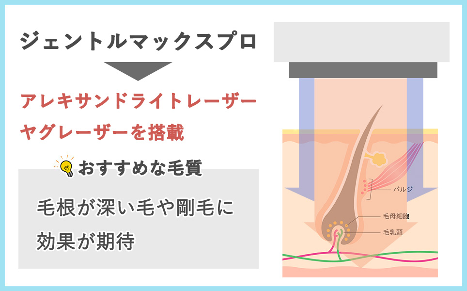 熱破壊式ジェントルマックスプロの説明の図説