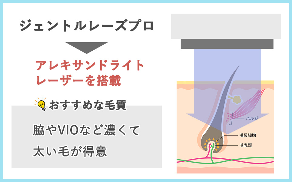 熱破壊式ジェントルレーズプロの説明の図説