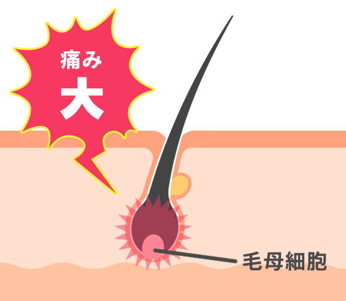 熱破壊式の図説