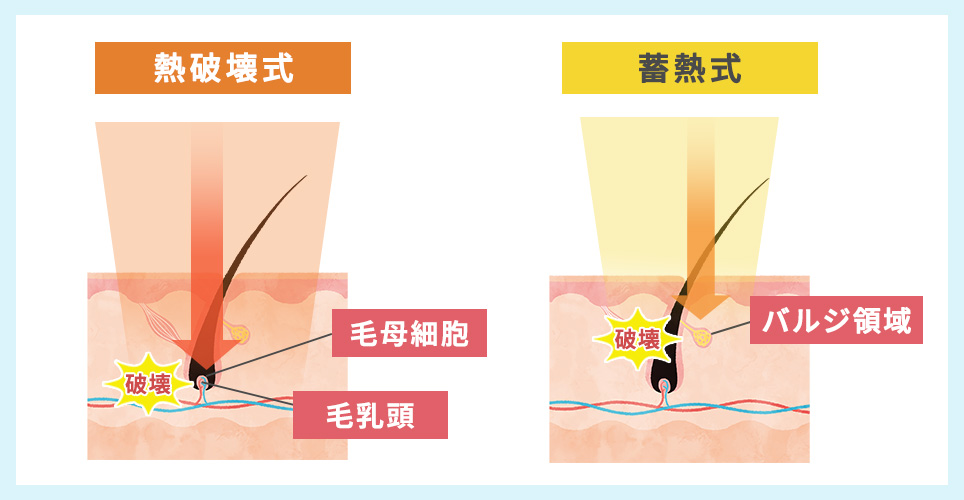 熱破壊式、蓄熱式の種類