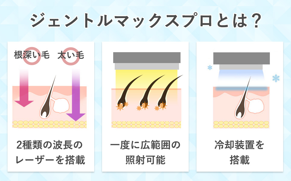 ジェントルマックスプロとは？図説