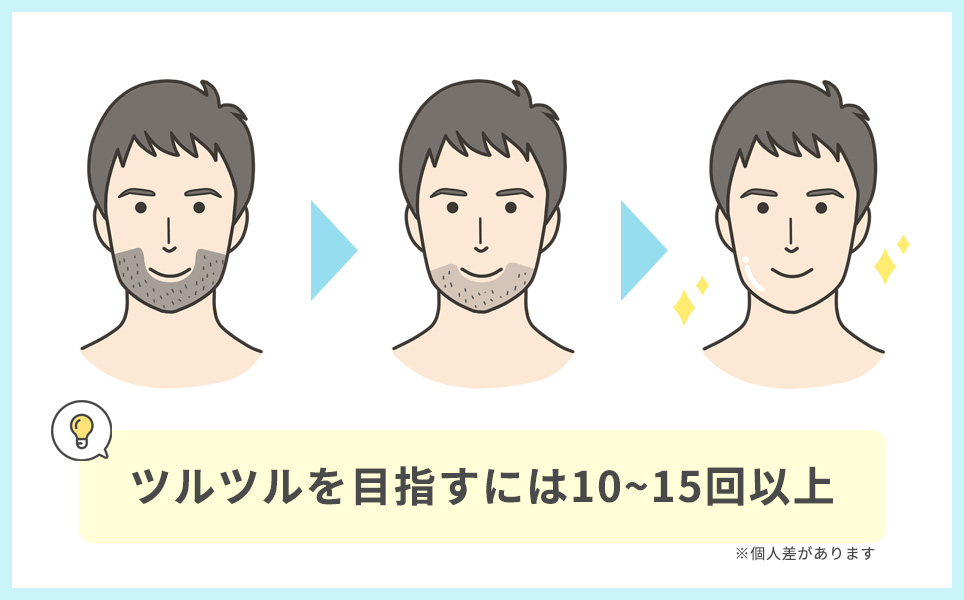 ヒゲ脱毛は10~15回でツルツルを目指せる