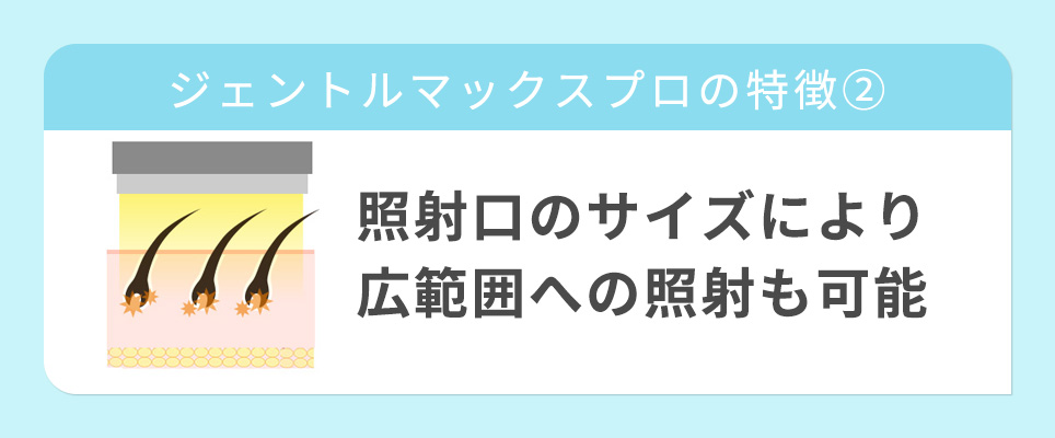 特徴②照射口のサイズにより広範囲への照射も可能