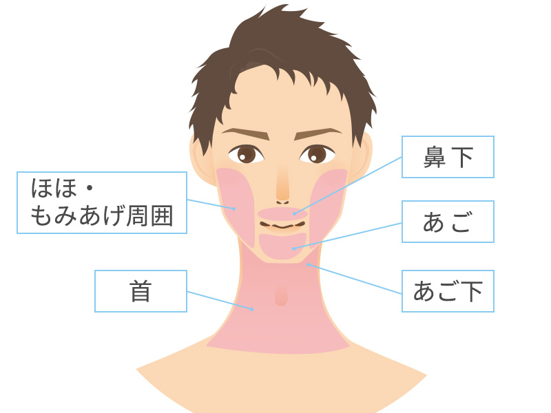 髭脱毛の部位一覧