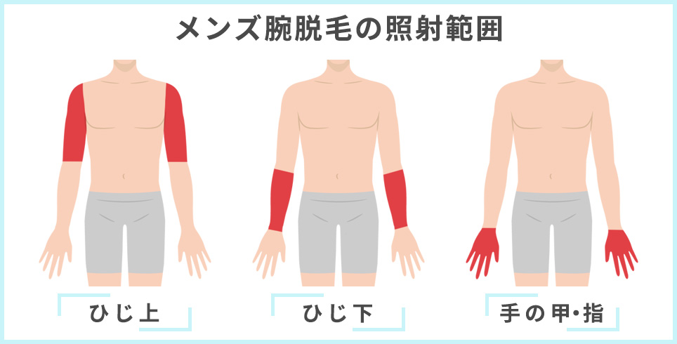 メンズ腕脱毛の照射範囲