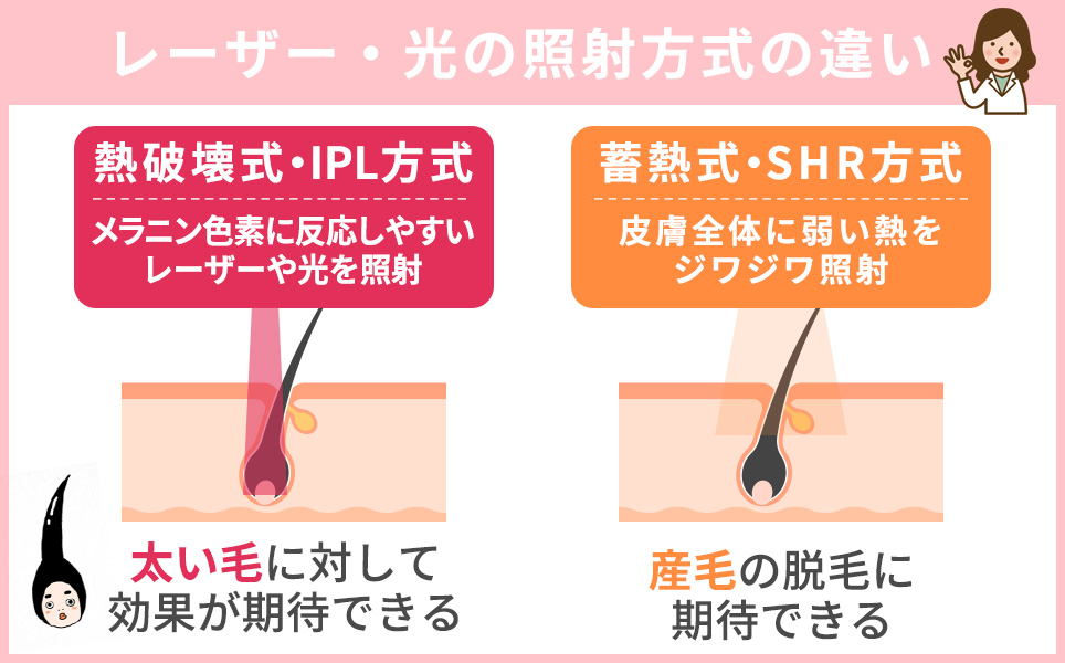 レーザー・光の照射方式の違い一覧