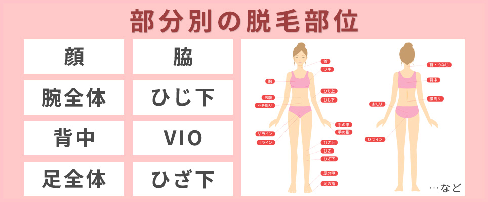 部分別の脱毛部位一例