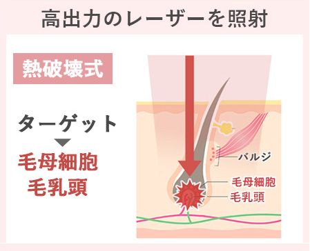 熱破壊式の図説