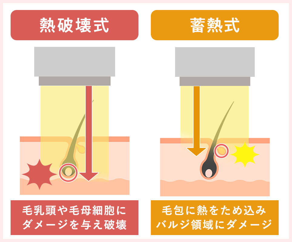 熱破壊式と蓄熱式の種類