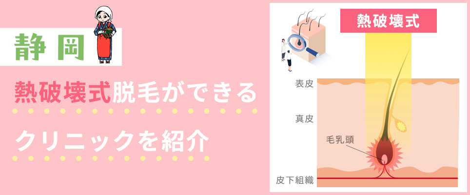 静岡で熱破壊式脱毛機を導入しているクリニック