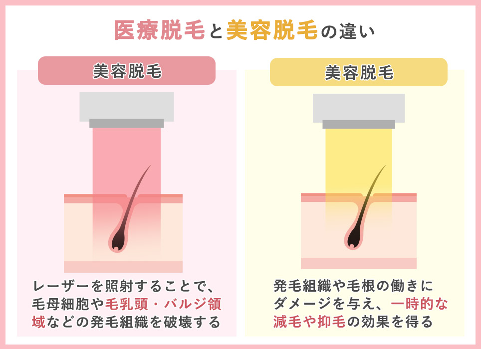 医療脱毛と美容脱毛の違い