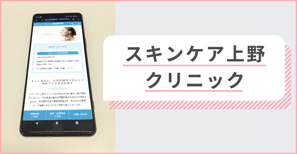 スキンケア上野クリニックの公式サイトを映したスマホの写真