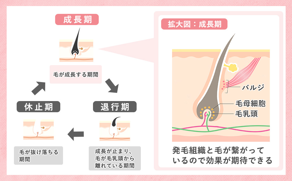 なじの医療脱毛の仕組み