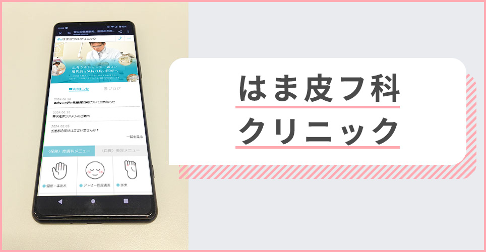 はま皮フ科クリニックの公式サイトを映したスマホの写真