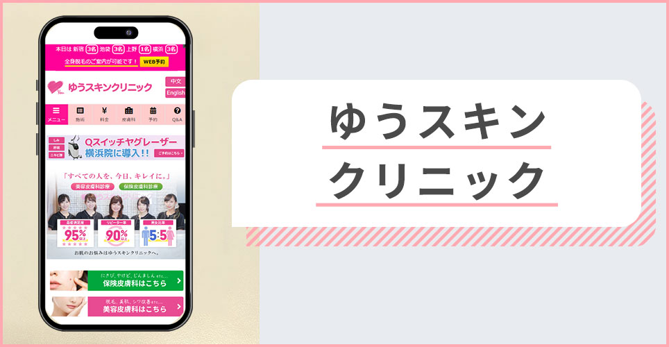 ゆうスキンクリニックの公式サイトを映したスマホの写真